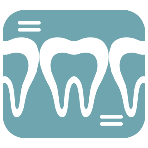 Dental X-ray of teeth